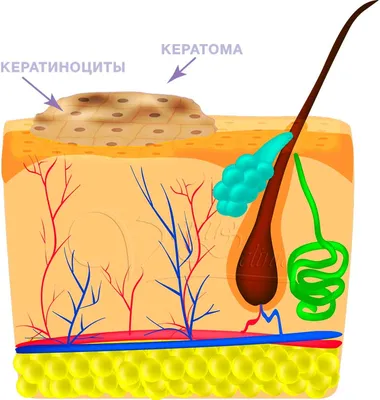 Лазерное удаление кератомы в Киеве. Лечение себорейного кератоза в Brenner  Clinic