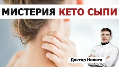 Кето сыпь / keto rash - что за чертовщина такая? Что такое кето сыпь? |  Доктор Ник | Терапевт-Гастроэнтеролог | Дзен