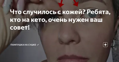 Ответ пользователю @Виктория можно ли фрукты на кето? и что можно ска... |  TikTok