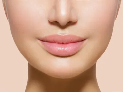 Хейлопластика - увеличение губ хирургическим путем - «Тяжело очень, но  результат хороший» | отзывы