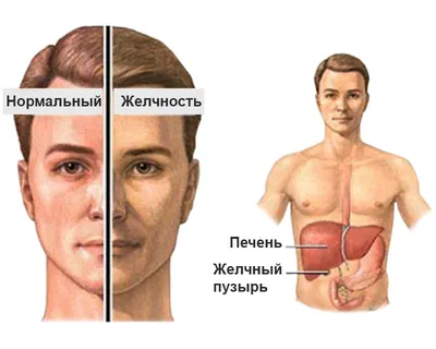 Болезнь Лайма (боррелиоз Лайма): симптомы с фото, последствия, диагностика  и лечение в Москве