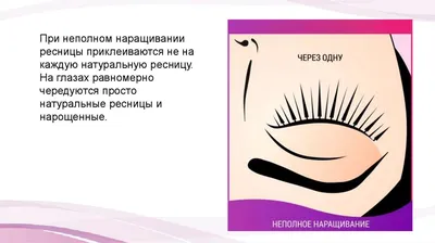 Ожог глаза после наращивания ресниц, покраснение - Вопрос офтальмологу - 03  Онлайн