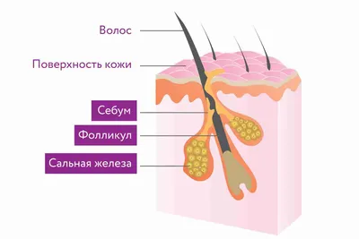 Как Вычесать Вшей - Марафет