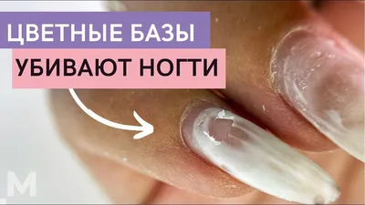 _nails_natali_zp_ - ОЖОГИ НОГТЕЙ😢 Есть 2 вида ожогов 🔥ХИМИЧЕСКИЙ ОЖОГ  из-за гель-лаковых баз и акригелей которые имеют всвоём составе высокий  процент метакриловой кислоты. Она накапливается в ногтевой пластине и  разрушает её. Вызывает