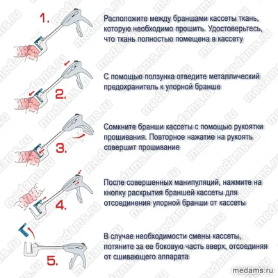 ХИРУРГИЧЕСКИЕ КАССЕТЫ СО СКОБАМИ, ПОДДЕРЖИВАЮЩИЕ НЕЛИНЕЙНО РАСПОЛОЖЕННЫЕ  СКОБЫ, И ХИРУРГИЧЕСКИЕ СШИВАЮЩИЕ ИНСТРУМЕНТЫ С ОБЩИМИ УГЛУБЛЕНИЯМИ ДЛЯ  ФОРМИРОВАНИЯ СКОБ