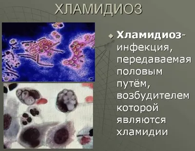 Окомистин глазные капли инструкция по применению, цена: Состав, показания,  действующее вещество