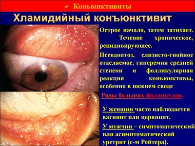 Врач-офтальмолог 👁 Москва (@yarkin_oftalm) • Instagram photos and videos