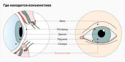 Конъюнктивит: виды и способы лечения | ВКонтакте