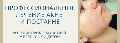 Дерматология в СПб, лечение кожных заболеваний, платные услуги