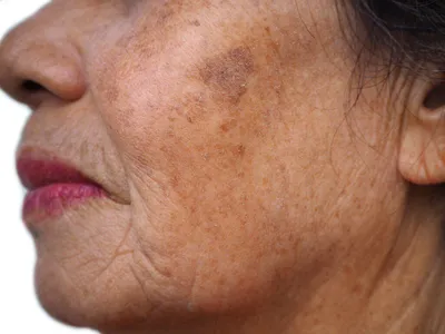 Секреты здоровья, которые пытается раскрыть ваша кожа | LIFE 40 PLUS | Дзен