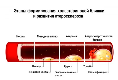 Шрамы от прыщей — разновидности и лечение.