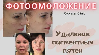 Китайская карта лица ➤ Публикация ⭐ Косметологической Клиники BeautyMED