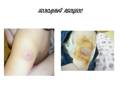 После вакцинации в Одессе погиб еще один ребенок. Врачи утверждают —  виноват порок сердца | Новости Одессы