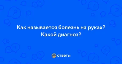 Холодовая экзема, крем для рук №75 Bosvellia Mirra 50 мл купить в  интернет-магазине Ярмарка Мастеров по цене 1800 ₽ – LCAXRU | Крем для рук,  Москва - доставка по России