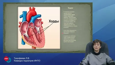 Дополнительная хорда в сердце берут ли в армию? | Получить военный билет  законно