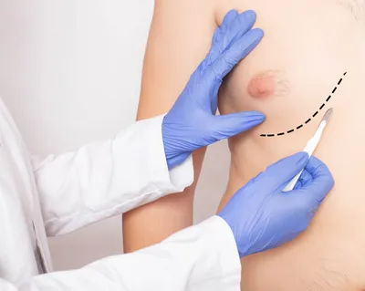 Thorax / Титульная страница / Презентация доклада: Хирургическое лечение килевидной  деформации грудной клетки