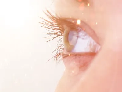 Операция по удалению кисты конъюнктивы глаза - «Женская проблема - киста  конъюктивы склеры» | отзывы