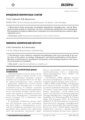 Птоз верхнего века - симптомы, причины возникновения, классификация, как  убрать с глаз