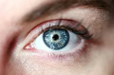 Отзыв о Глазные капли Alcon Неванак | Киста конъюнктивы - безболезненное  лечение