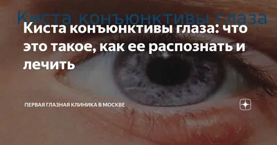 Операция по удалению кисты конъюнктивы глаза | отзывы