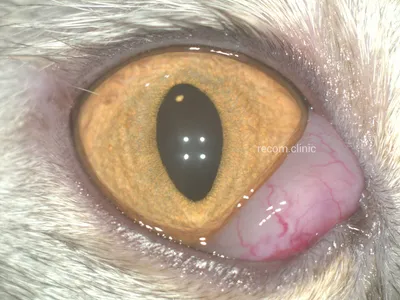 Из-за чего желтеют белки глаз? | блог Хирургия глаза