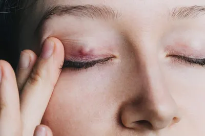 Детская офтальмология в Одинцово | Лечение глаз у детей
