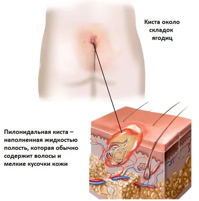 Киста слюнной железы, цены на удаление кисты слюнной железы в Москве в  стоматологии АО Медицина