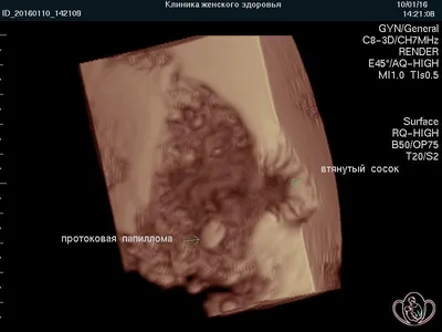 УЗИ молочных желез МАММОЛОГом с ОПЫТом | Курортная КЛИНИКА женского ЗДОРОВЬЯ