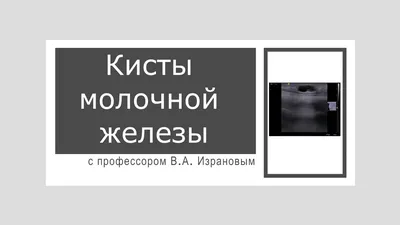 Доктор Рябчиков Д.А. - Чаще всего кисты молочных желез обнаруживаются при  пальпации либо на УЗИ. Пациенты, как правило, замечают неладное во время  самостоятельного осмотра. Кисты могут длительное время протекать  бессимптомно. Если киста