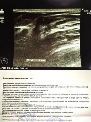 BI-RADS — исследование молочных желез — 24Radiology.ru