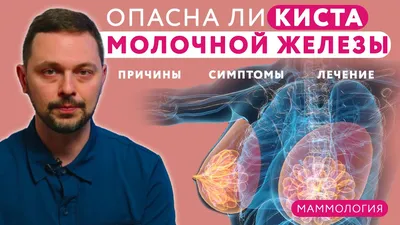 УЗИ (Ультразвуковое исследование) молочных желез - «26 лет в диагнозе ФКМ!  Делаю УЗИ молочных желез 2 раза в год. Как пережить подозрения на  онкологию? Как отличить фиброаденому от кисты на УЗИ? Классификация