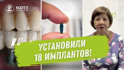 Фолликулярная киста зуба - Сеть стоматологических клиник Санкт-Петербурга -  Мир стоматологии