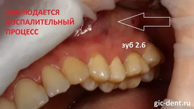 Выпадение третьего века у кошки: причины, лечение, фото