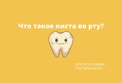 Лечение кисты зуба в Москве цены | Симптомы, причины и методы удаления