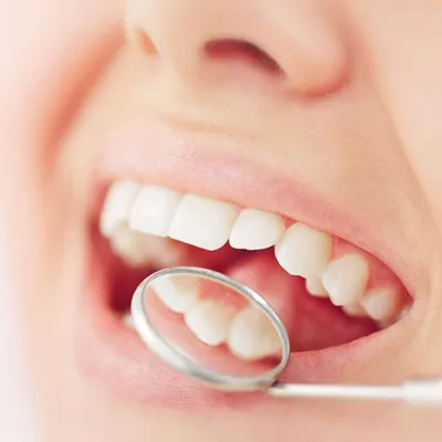 Удаление кисты зуба в Смоленске - цена операции в стоматологии «Family  Smile»