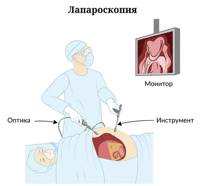 Диагностика и лечение новообразований кожи и подкожной клетчатки в  Краснодаре в клинике УРО-ПРО