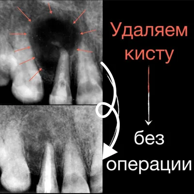 Прицельный снимок зуба по доступной стоимости в Москве