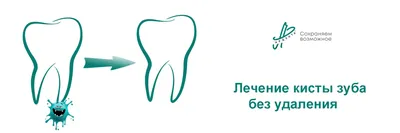 Киста зуба удалять нельзя лечить! - блог стоматолога TopSmile