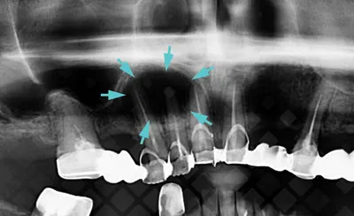 Можно ли проводить рентген детям? | Стоматология Ас-Стом | Санкт-Петербург  (СПб)