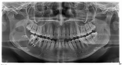 Ортопантомограмма (ОПТГ) зубов в Москве недорого. Стоматологические услуги  в клинике Доктор Степман
