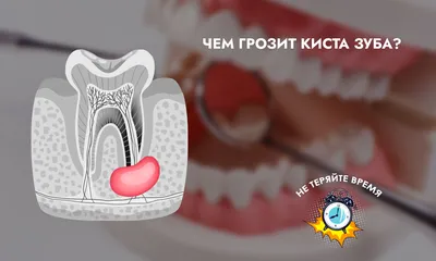 Клинический случай 1 зубной канал | Стоматологическая клиника Оланко каналы  1 Оланко™