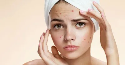Косметолог Джессики Альбы рассказала, как предотвратить кистозное акне -  Beauty HUB