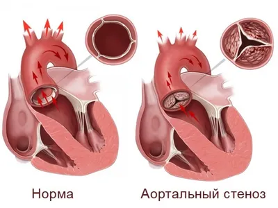 Миниинвазивная кардиохирургия | Moscow