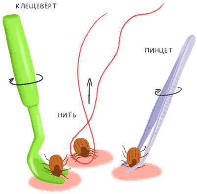 Профилактика и защита от клещей. Что делать, если укусил клещ? —  Кизилюртовская центральная городская больница