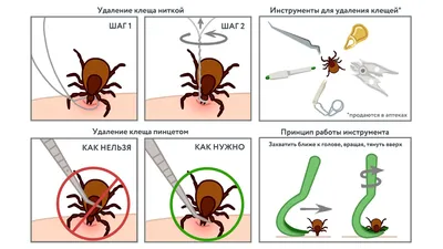 Как выглядит присосавшийся клещ? Укус клеща. Первая помощь