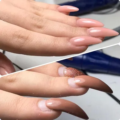 Стильный маникюр Hany Nails. Израиль / Кирьят Ям - 💅 Клюющие ногти. Hany  Nails (Израиль / Кирьят Ям) Часто мастера маникюра встречают в работе \"клюющие  ногти\". Это ногти, которые растут вниз. 🔹️Почему