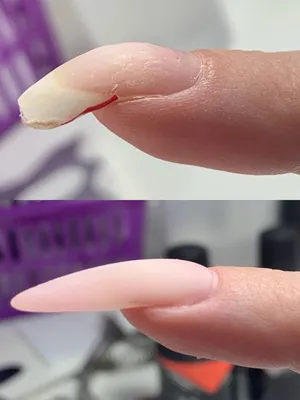 Shimmer nail studio - Клюющие ногти или сильно загнутые ногти нужно ВСЕГДА  ПОДЫМАТЬ! 👆💪Именно для таких случаев и придумали гель - твёрдый материал,  который приведёт ваш ногтик в порядок. Печально, что некоторые