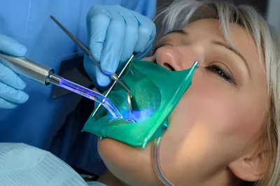 Коффердам в стоматологии Стоматология в Смоленске, лечение зубов  современными методами.