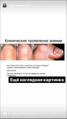 12 проблем с ногтями, которые служат симптомами заболеваний – не пропустите  их | ВКонтакте