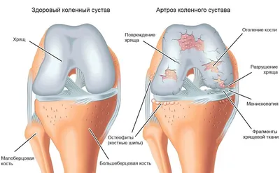 АНАТОМИЯ | СПОРТИВНАЯ ТРАВМАТОЛОГИЯ